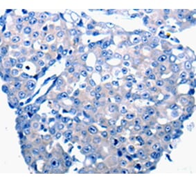 Immunohistochemistry - CCL2 Antibody from Signalway Antibody (36781) - Antibodies.com