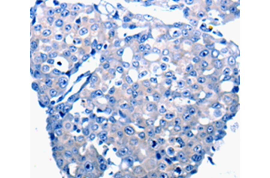 Immunohistochemistry - CCL2 Antibody from Signalway Antibody (36781) - Antibodies.com
