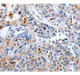 Immunohistochemistry - CDK3 Antibody from Signalway Antibody (36787) - Antibodies.com