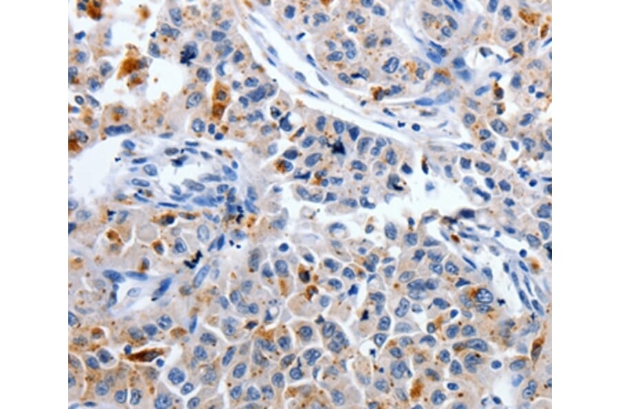 Immunohistochemistry - CDK3 Antibody from Signalway Antibody (36787) - Antibodies.com