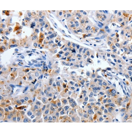 Immunohistochemistry - CDK3 Antibody from Signalway Antibody (36787) - Antibodies.com