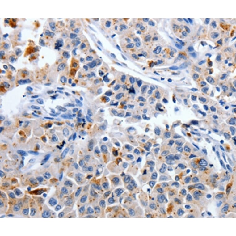 Immunohistochemistry - CDK3 Antibody from Signalway Antibody (36787) - Antibodies.com