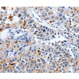 Immunohistochemistry - CDK3 Antibody from Signalway Antibody (36787) - Antibodies.com