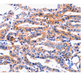 Immunohistochemistry - CFTR Antibody from Signalway Antibody (36791) - Antibodies.com