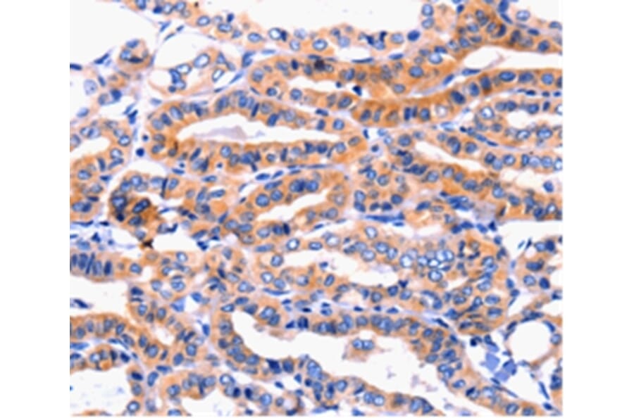 Immunohistochemistry - CFTR Antibody from Signalway Antibody (36791) - Antibodies.com