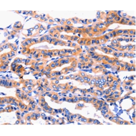 Immunohistochemistry - CFTR Antibody from Signalway Antibody (36791) - Antibodies.com