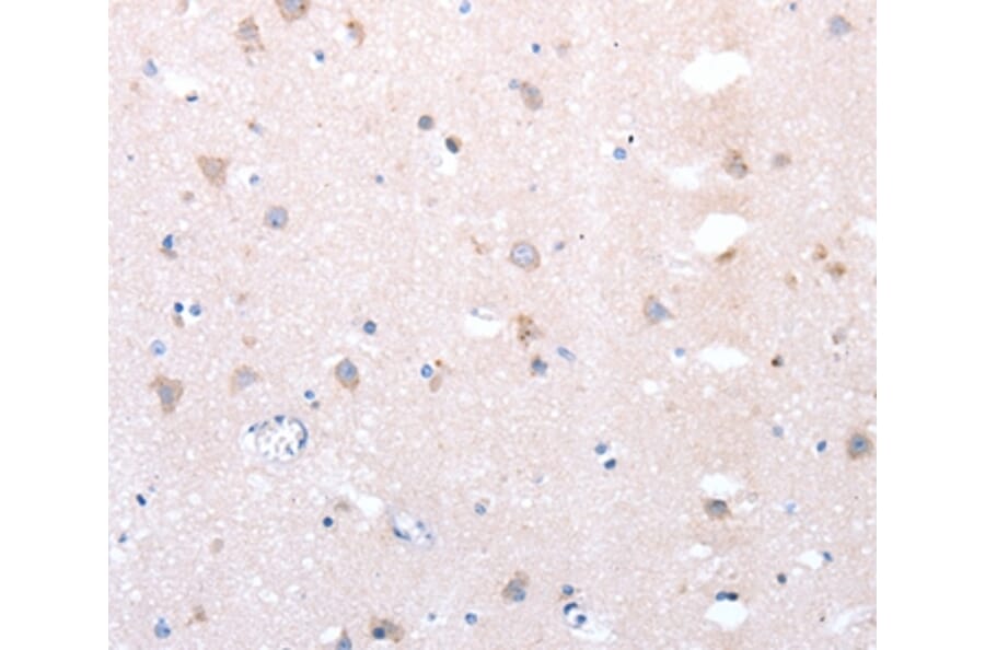 Immunohistochemistry - DXT1 Antibody from Signalway Antibody (36825) - Antibodies.com