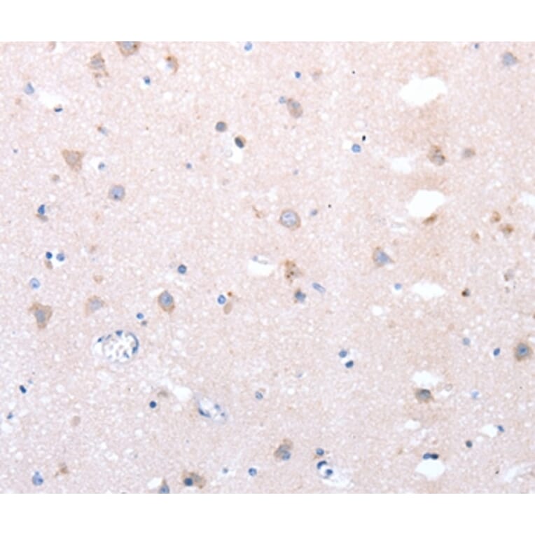 Immunohistochemistry - DXT1 Antibody from Signalway Antibody (36825) - Antibodies.com
