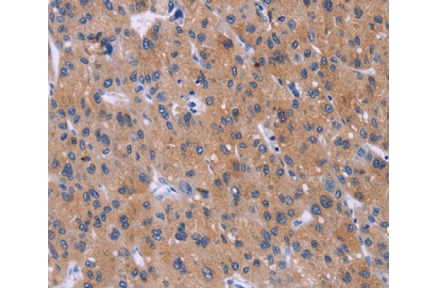 Immunohistochemistry - DVL2 Antibody from Signalway Antibody (36830) - Antibodies.com