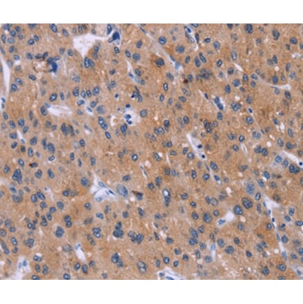 Immunohistochemistry - DVL2 Antibody from Signalway Antibody (36830) - Antibodies.com