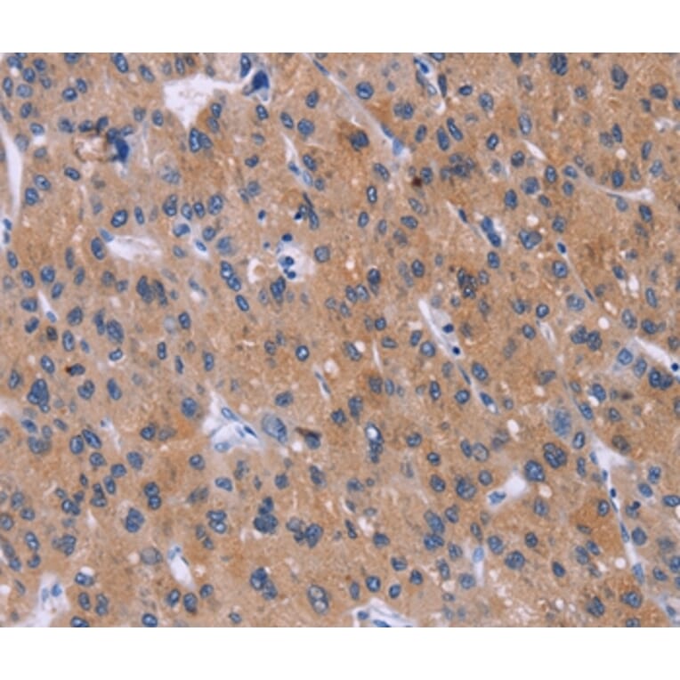 Immunohistochemistry - DVL2 Antibody from Signalway Antibody (36830) - Antibodies.com