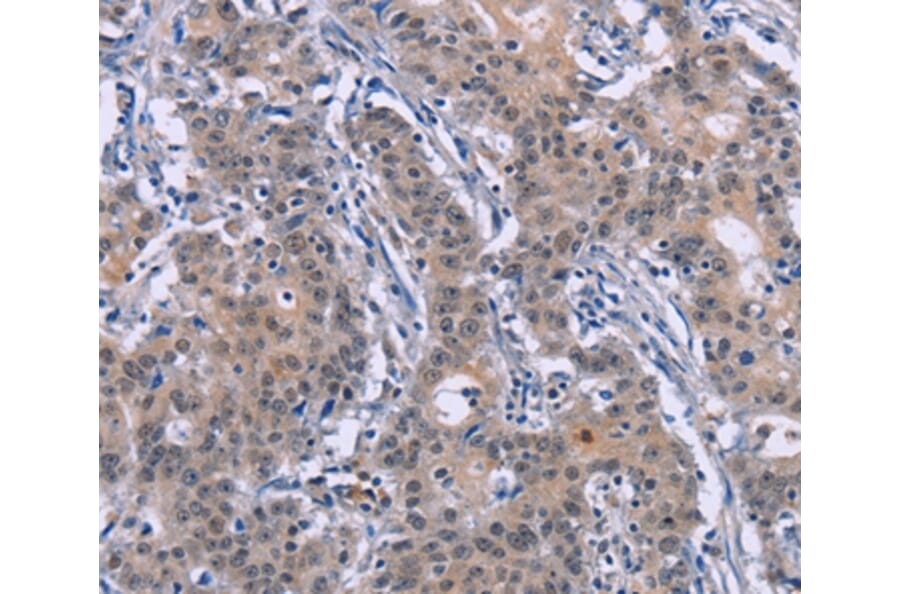 Immunohistochemistry - DVL2 Antibody from Signalway Antibody (36830) - Antibodies.com