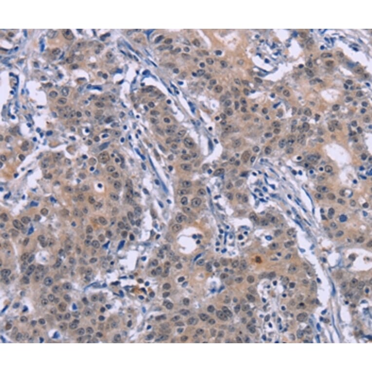 Immunohistochemistry - DVL2 Antibody from Signalway Antibody (36830) - Antibodies.com