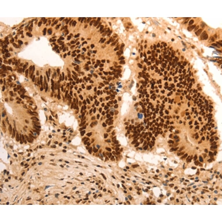 Immunohistochemistry - E2F7 Antibody from Signalway Antibody (36831) - Antibodies.com