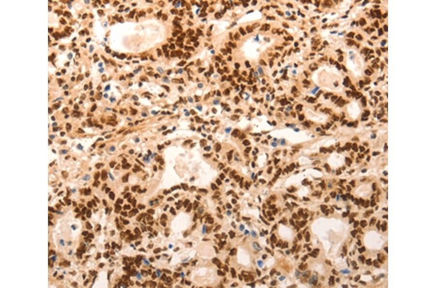 Immunohistochemistry - E2F7 Antibody from Signalway Antibody (36831) - Antibodies.com