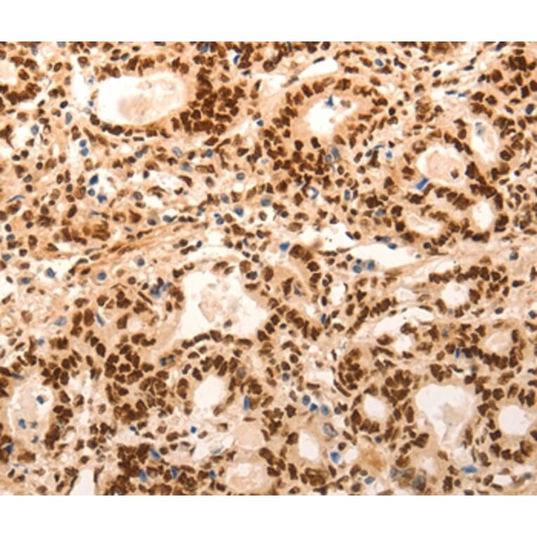 Immunohistochemistry - E2F7 Antibody from Signalway Antibody (36831) - Antibodies.com