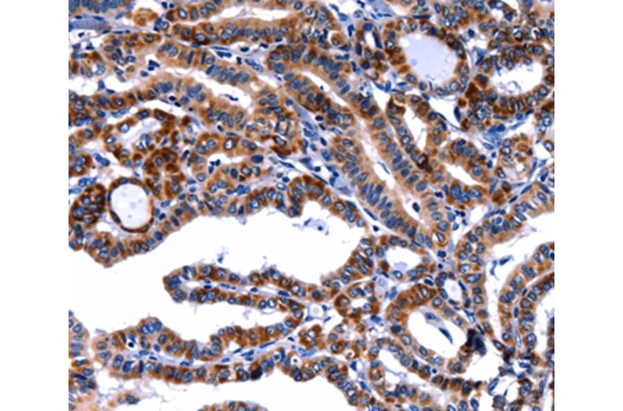 Immunohistochemistry - FBN1 Antibody from Signalway Antibody (36851) - Antibodies.com