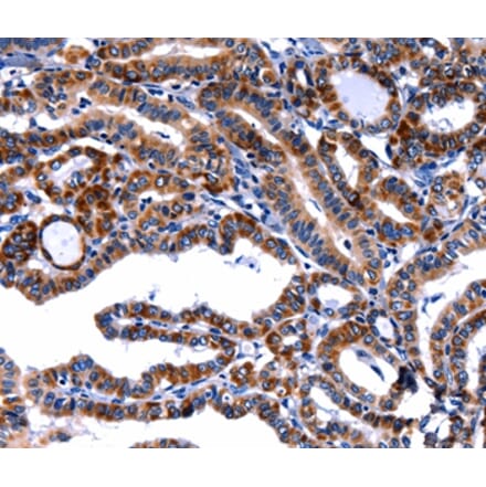 Immunohistochemistry - FBN1 Antibody from Signalway Antibody (36851) - Antibodies.com