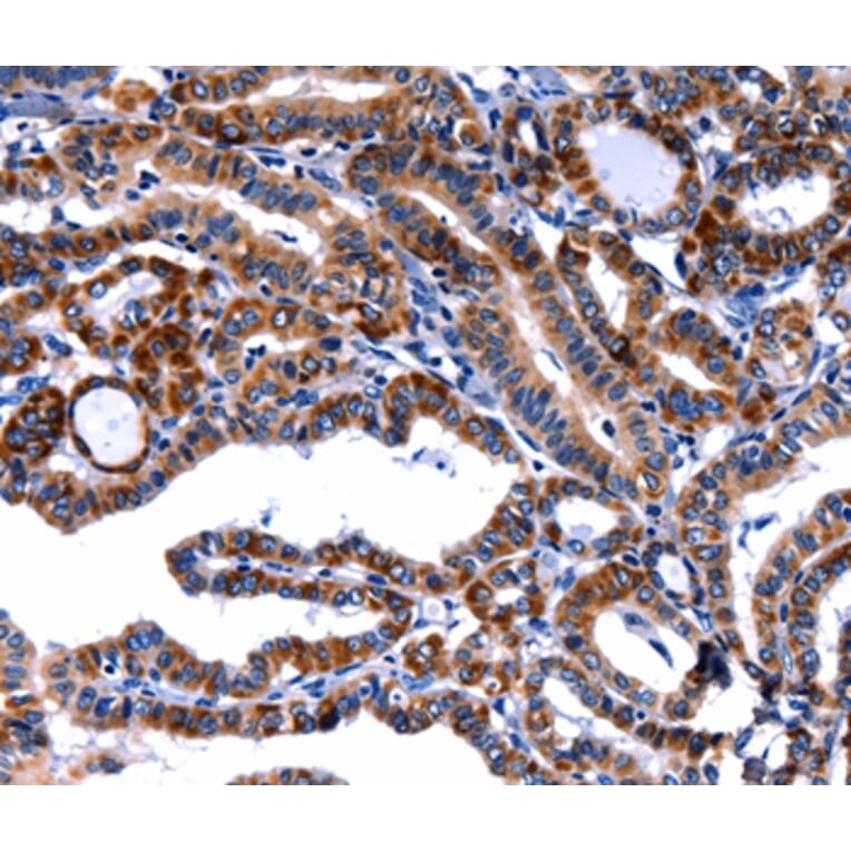 Immunohistochemistry - FBN1 Antibody from Signalway Antibody (36851) - Antibodies.com