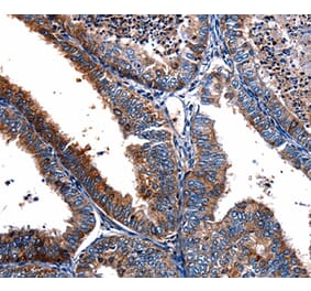 Immunohistochemistry - FPR2 Antibody from Signalway Antibody (36856) - Antibodies.com