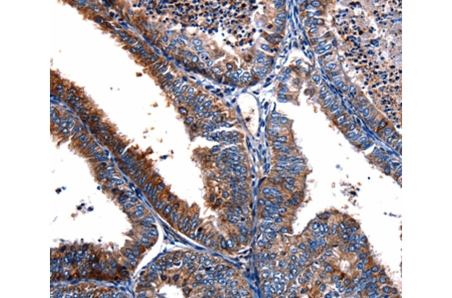 Immunohistochemistry - FPR2 Antibody from Signalway Antibody (36856) - Antibodies.com