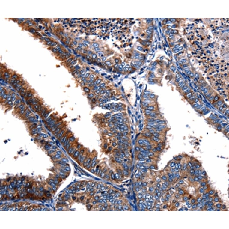 Immunohistochemistry - FPR2 Antibody from Signalway Antibody (36856) - Antibodies.com