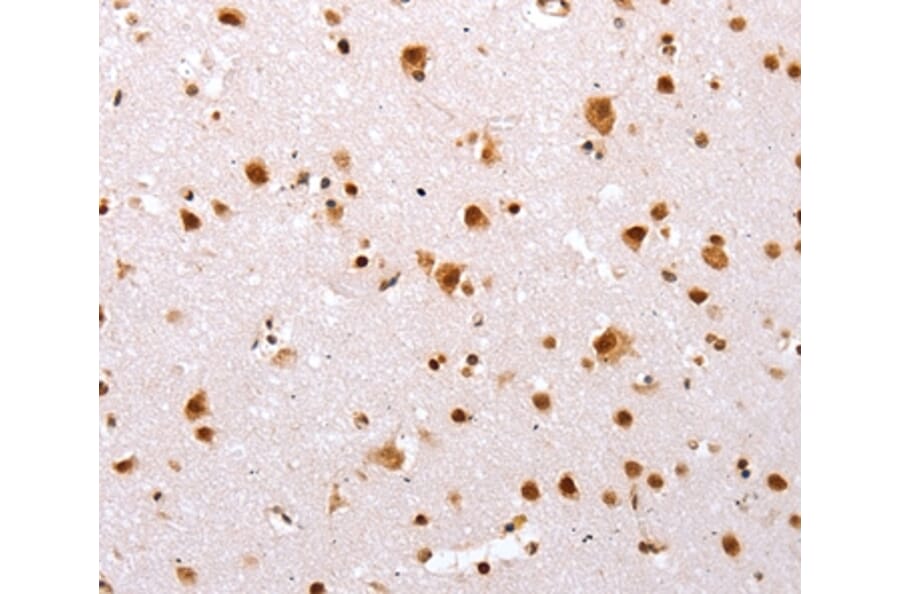 Immunohistochemistry - TBX2 Antibody from Signalway Antibody (36873) - Antibodies.com