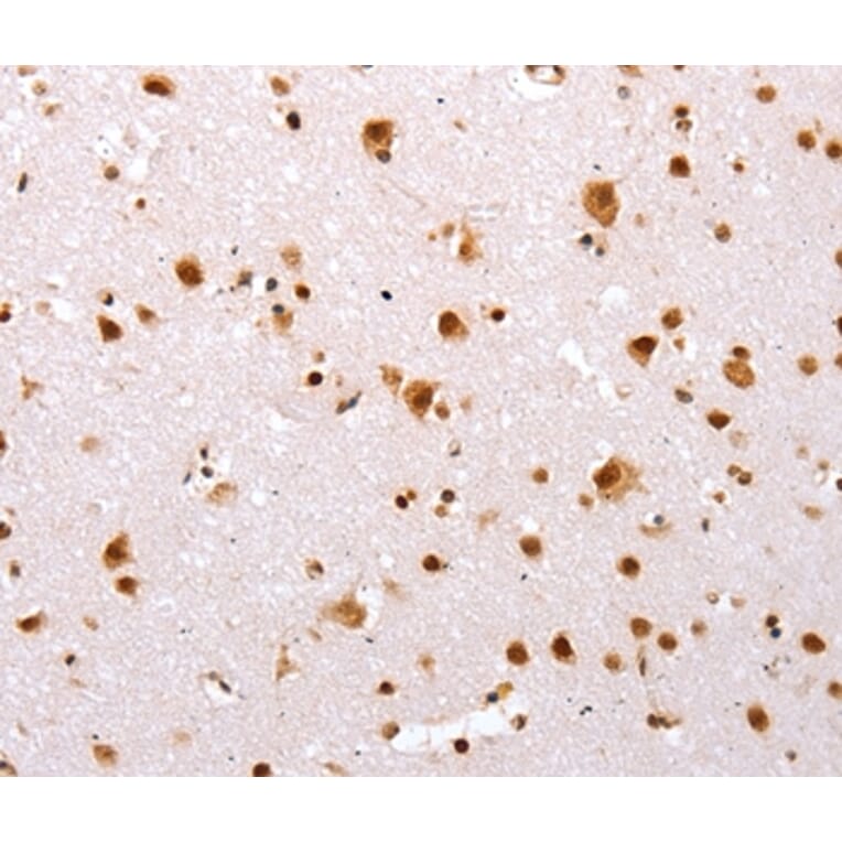 Immunohistochemistry - TBX2 Antibody from Signalway Antibody (36873) - Antibodies.com