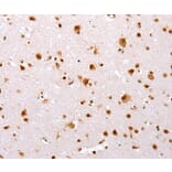 Immunohistochemistry - TBX2 Antibody from Signalway Antibody (36873) - Antibodies.com