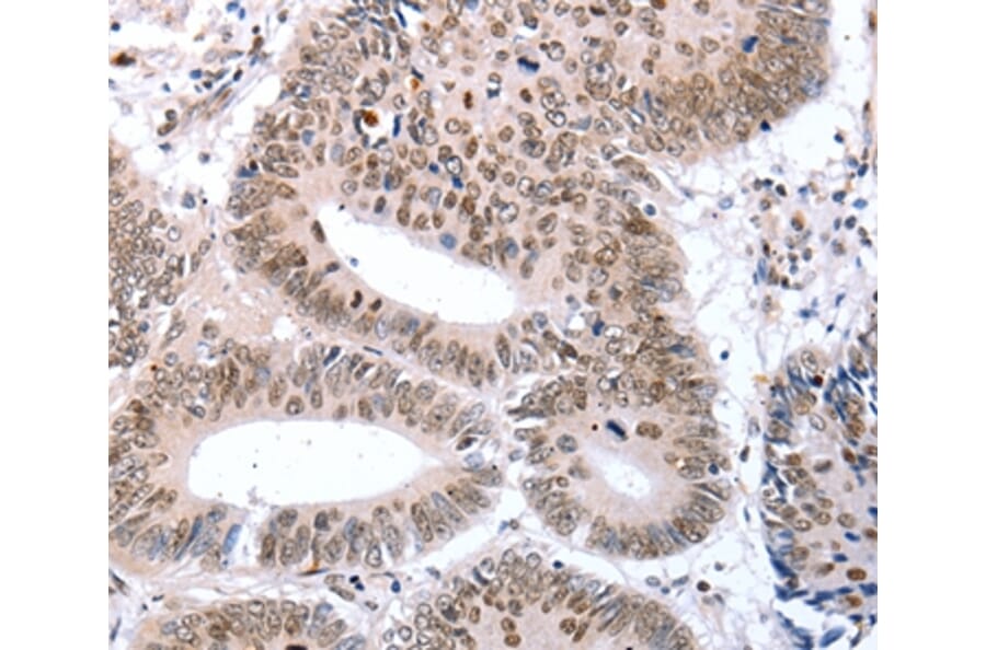Immunohistochemistry - TBX2 Antibody from Signalway Antibody (36873) - Antibodies.com