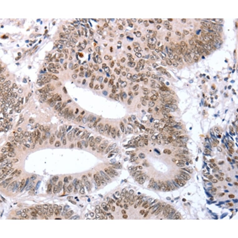 Immunohistochemistry - TBX2 Antibody from Signalway Antibody (36873) - Antibodies.com