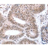 Immunohistochemistry - TBX2 Antibody from Signalway Antibody (36873) - Antibodies.com