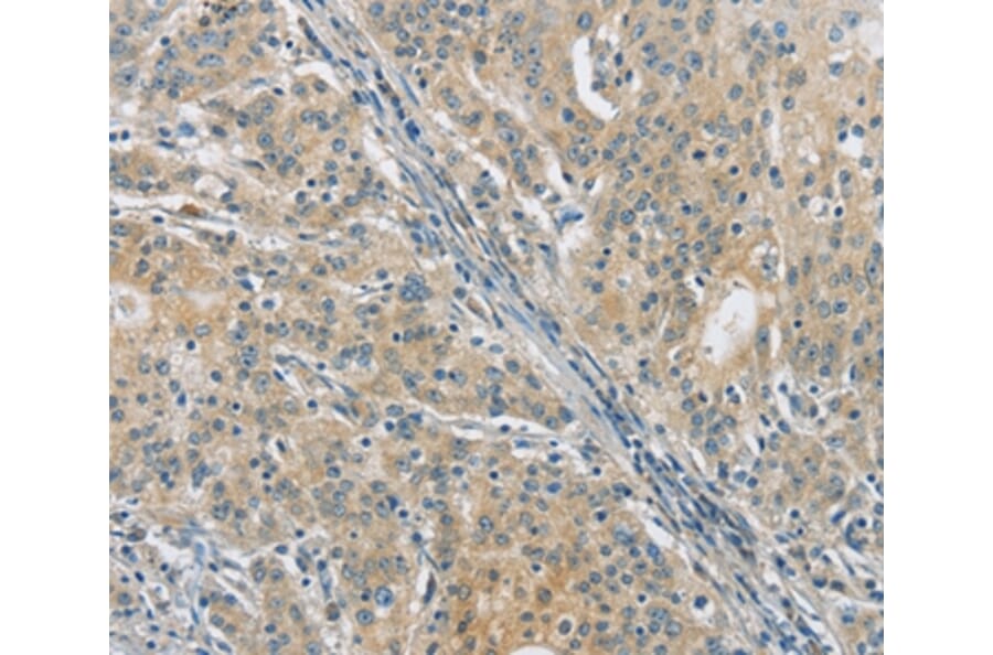 Immunohistochemistry - PKD1 Antibody from Signalway Antibody (36876) - Antibodies.com