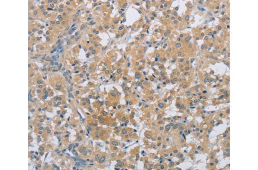 Immunohistochemistry - PKD1 Antibody from Signalway Antibody (36876) - Antibodies.com