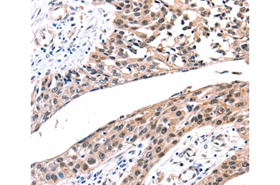 Immunohistochemistry - GJB2 Antibody from Signalway Antibody (36893) - Antibodies.com