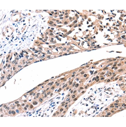 Immunohistochemistry - GJB2 Antibody from Signalway Antibody (36893) - Antibodies.com