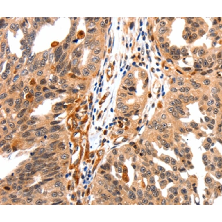 Immunohistochemistry - GAS6 Antibody from Signalway Antibody (36894) - Antibodies.com