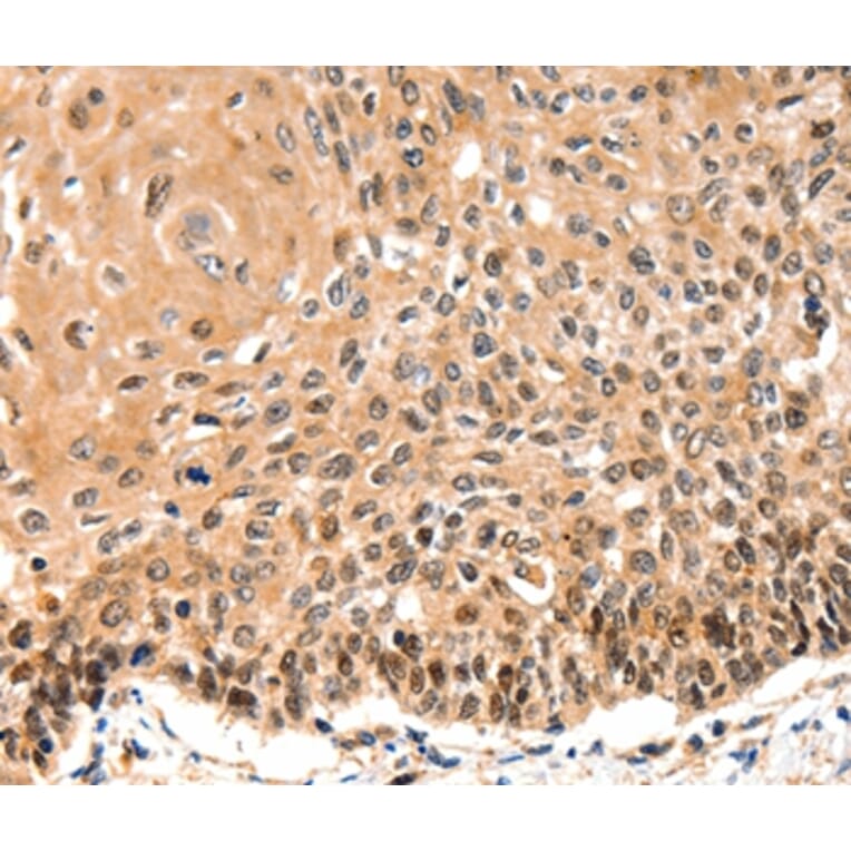 Immunohistochemistry - GAS6 Antibody from Signalway Antibody (36894) - Antibodies.com