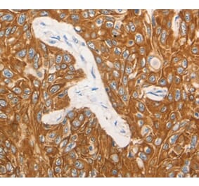 Immunohistochemistry - CSF3 Antibody from Signalway Antibody (36895) - Antibodies.com
