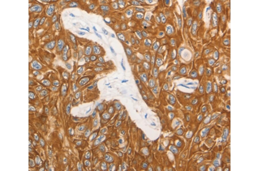 Immunohistochemistry - CSF3 Antibody from Signalway Antibody (36895) - Antibodies.com