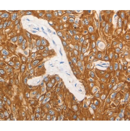 Immunohistochemistry - CSF3 Antibody from Signalway Antibody (36895) - Antibodies.com