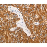 Immunohistochemistry - CSF3 Antibody from Signalway Antibody (36895) - Antibodies.com
