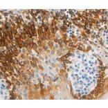 Immunohistochemistry - CSF3 Antibody from Signalway Antibody (36895) - Antibodies.com