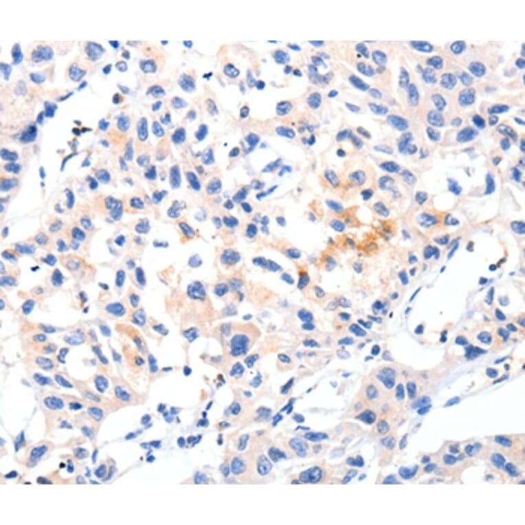 Immunohistochemistry - MSTN Antibody from Signalway Antibody (36897) - Antibodies.com
