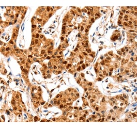 Immunohistochemistry - GRM4 Antibody from Signalway Antibody (36912) - Antibodies.com