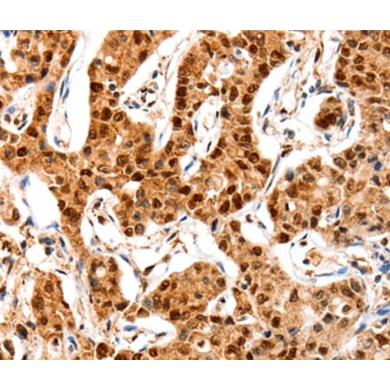 Immunohistochemistry - GRM4 Antibody from Signalway Antibody (36912) - Antibodies.com