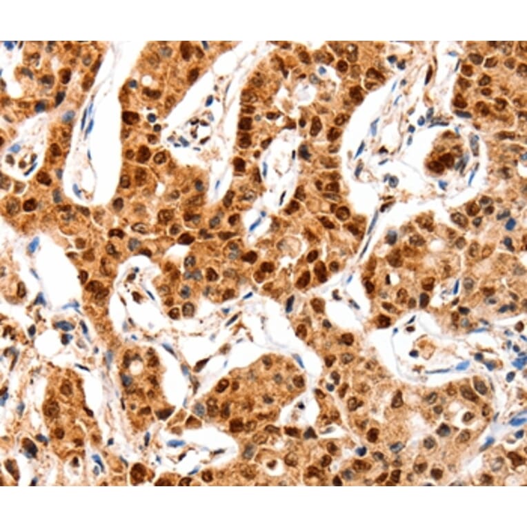 Immunohistochemistry - GRM4 Antibody from Signalway Antibody (36912) - Antibodies.com