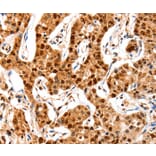 Immunohistochemistry - GRM4 Antibody from Signalway Antibody (36912) - Antibodies.com