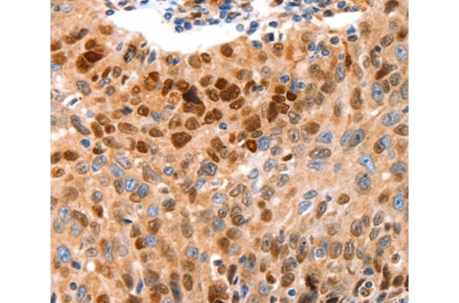 Immunohistochemistry - GRM4 Antibody from Signalway Antibody (36912) - Antibodies.com