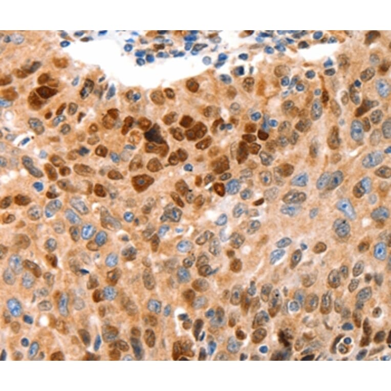 Immunohistochemistry - GRM4 Antibody from Signalway Antibody (36912) - Antibodies.com